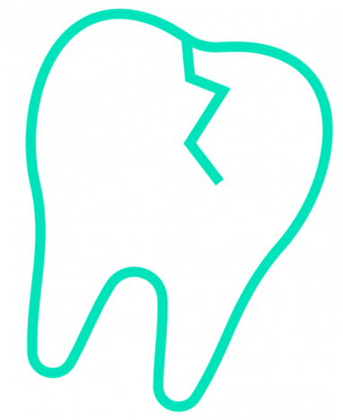 5c61cc9bda78f06e03dce43b_noun_cracked-tooth_245460-2-530x650