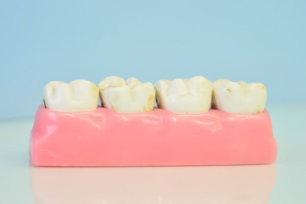 Teeth Model